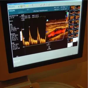 2D ECHO