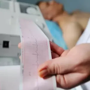 ECG