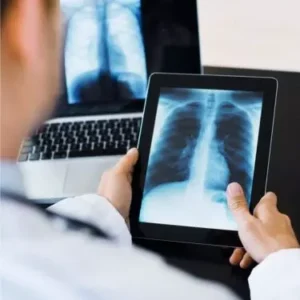 HEART LUNG TRANSPLANT